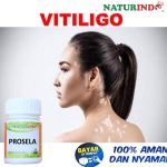 Obat Vitiligo Yang Sudah Terbukti