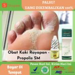 Obat Sakit Telapak Kaki
