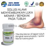 Obat Keseleo Tangan Obat Keseleo Tangan