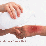 Cara Mengobati Luka Infeksi Secara Alami