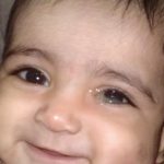 Cara Mengobati Sakit Mata Belekan