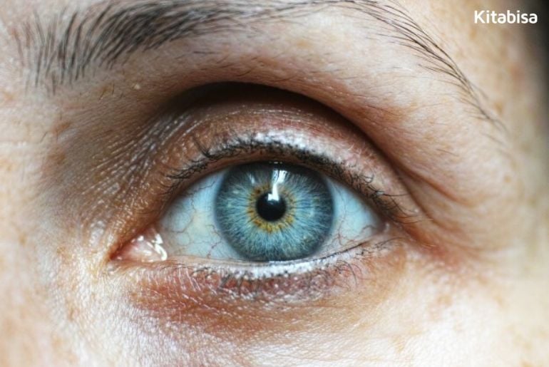 Cara Mengobati Mata Katarak Cara Mengobati Mata Katarak