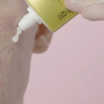 Obat Penghilang Bekas Jerawat Di Apotik