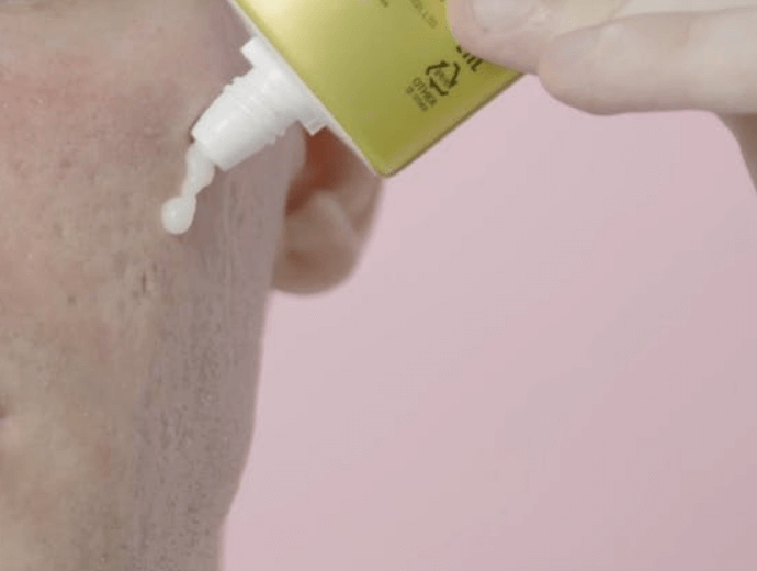 Obat Penghilang Bekas Jerawat Di Apotik