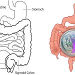 Obat Gangguan Pencernaan Obat Gangguan Pencernaan
