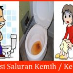 Mengobati Infeksi Saluran Kemih