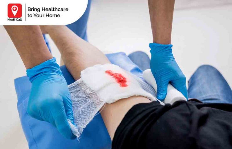 Cara Mengobati Abses Tanpa Operasi Cara Mengobati Abses Tanpa Operasi