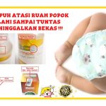 Cara Mengobati Ruam Popok Pada Bayi Cara Mengobati Ruam Popok Pada Bayi