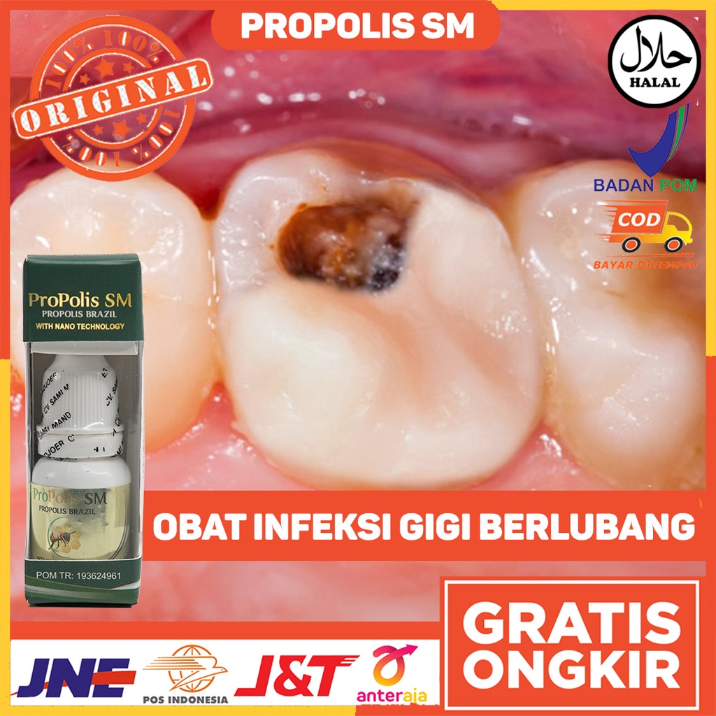 Obat Gigi Sensitif