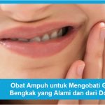 Sakit Gigi Obatnya