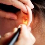 Cara Mengobati Ambeien Berdarah