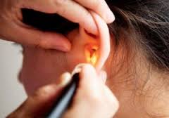 Cara Mengobati Ambeien Berdarah Cara Mengobati Ambeien Berdarah