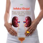 Obat Infeksi Kandung Kemih Obat Infeksi Kandung Kemih