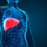 Cara Mengobati Hepatitis