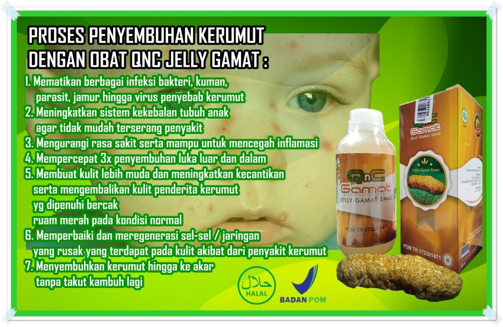 Obat Kerumut Obat Kerumut