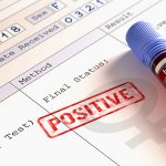 Pengobatan Hiv Aids Pengobatan Hiv Aids