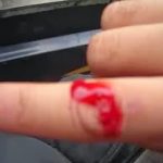 Obat Untuk Luka Dalam