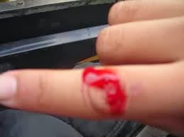 Obat Untuk Luka Dalam