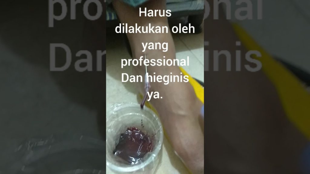 Pengobatan Fashdu Pengobatan Fashdu