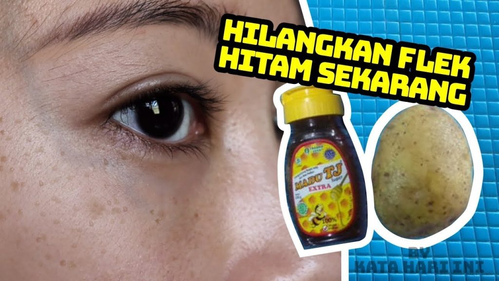 Obat Untuk Flek Hitam Di Wajah Obat Untuk Flek Hitam Di Wajah