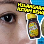 Obat Untuk Flek Hitam Di Wajah