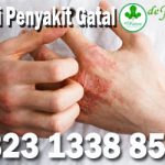 Obat Gatal Paling Ampuh Di Apotik