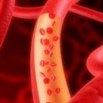 Obat Memperlancar Peredaran Darah Obat Memperlancar Peredaran Darah