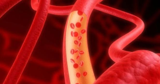 Obat Memperlancar Peredaran Darah Obat Memperlancar Peredaran Darah