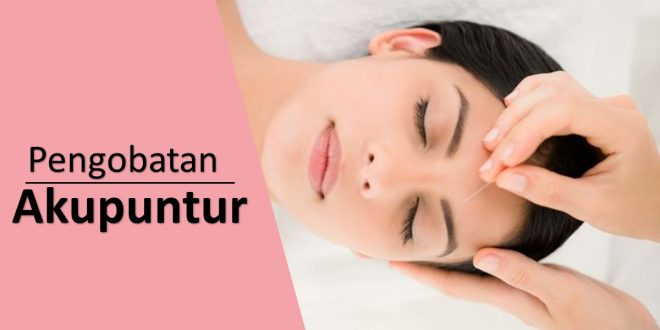 Pengobatan Akupuntur