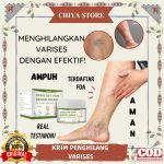 Obat Varises Alami
