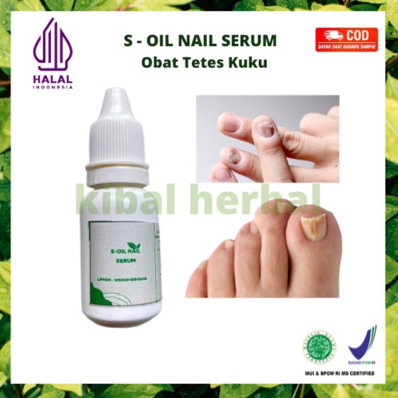 Obat Penumbuh Kuku Obat Penumbuh Kuku