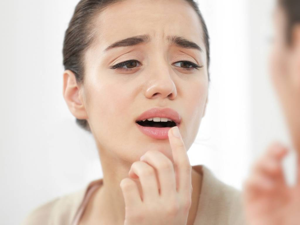 Mengobati Sariawan Di Lidah Mengobati Sariawan Di Lidah