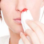 Obat Mimisan Di Apotik