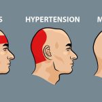 Obat Alami Sakit Kepala Belakang