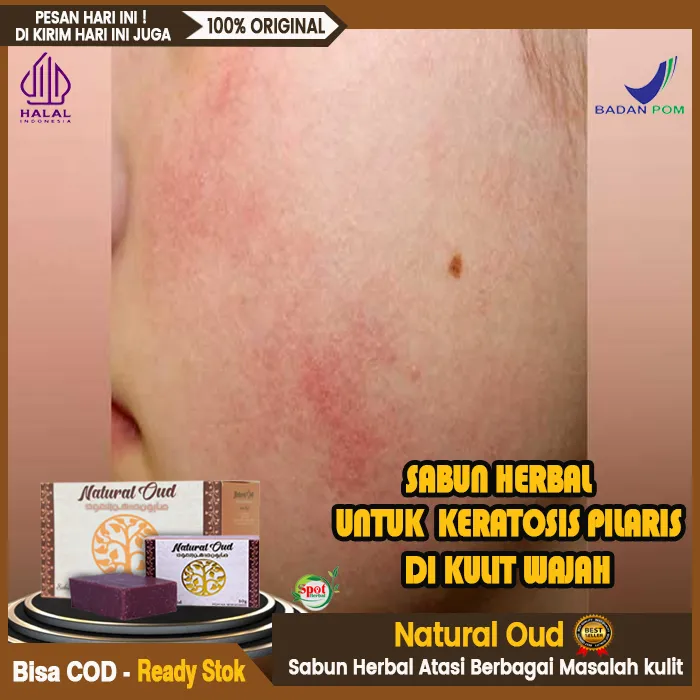 Flowchart Penjualan Kredit