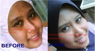 Contoh Surat Terbuka Untuk Bupati